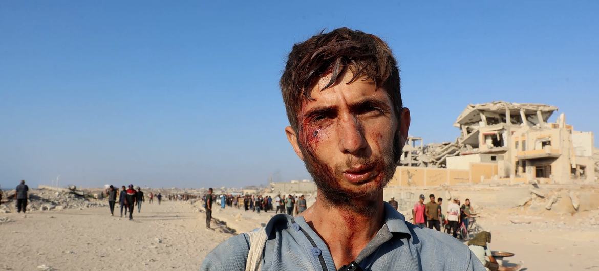 A young Gazan was injured while trying to obtain aid.